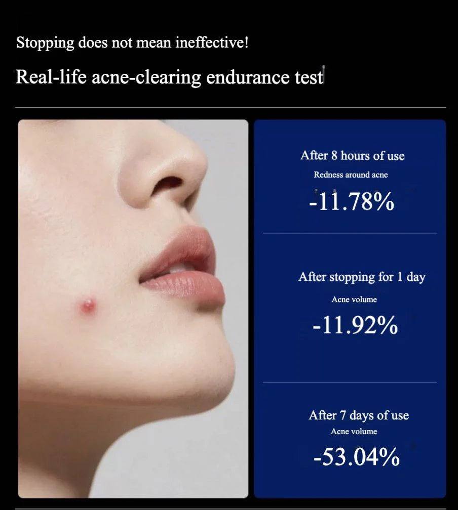 BIGDROP Precision Acne Spot Serum 03:00